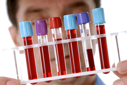 Сдать анонимно анализы крови на СПИД